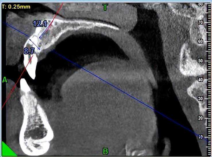 十二生肖首饰佩戴禁忌！看看自己踩雷了没…干货12生肖佩戴禁忌！