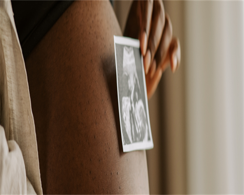 再次提醒：长在4个部位的痣，与癌症“息息相关”，建议及时处理